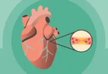 What to do When Someone Has a Heart Attack: First 10 Minutes what to do during heart attack