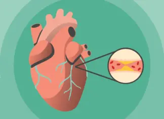 what to do during heart attack