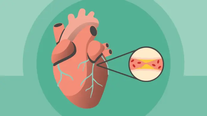 heart-attack-causes-and-risk-factors-alt-1440x810 what to do during heart attack