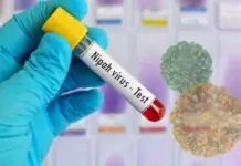 Nipah Virus 2026: Outbreak in West Bengal Triggers Asia Travel Alerts West Bengal faces a Nipah outbreak. Learn about the new airport checks in Thailand and Nepal, virus symptoms, and how to stay safe in 2026.