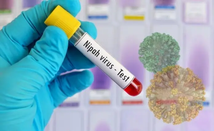 2su9m64k_nipah_625x300_14_July_2 West Bengal faces a Nipah outbreak. Learn about the new airport checks in Thailand and Nepal, virus symptoms, and how to stay safe in 2026.