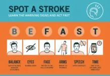 How to Reduce Stroke Risk: Prevention Tips & BE FAST Warning Signs